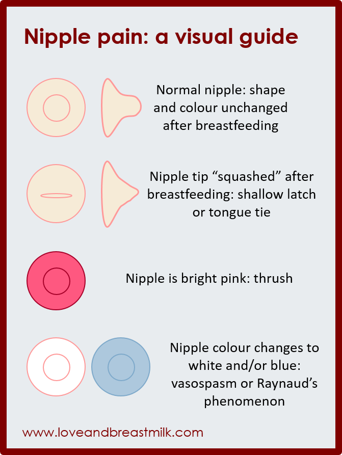 Nipples Problems 101